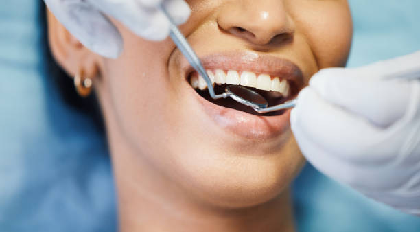 Best Emergency Dental Care for Broken or Chipped Teeth in Helena Valley Southeast, MT