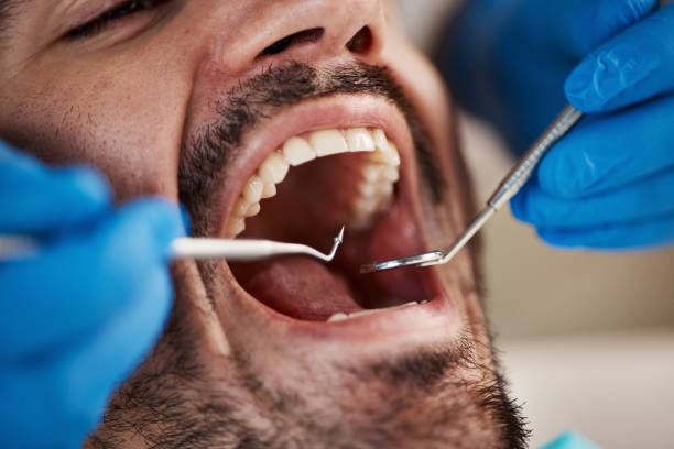 Best Emergency Treatment for Dental Infections or Abscesses in Helena Valley Southeast, MT